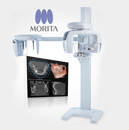 Morita - 2D i 3D RTG dijagnostika
